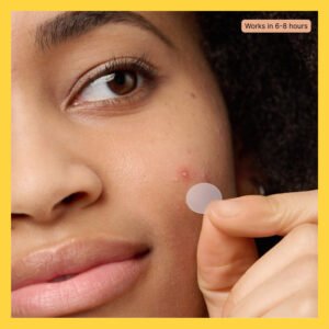 Mighty Patch Original 36pcs Pimple Patch